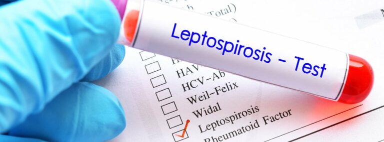 Aparece primer muerto por leptospirosis en la Zona 8